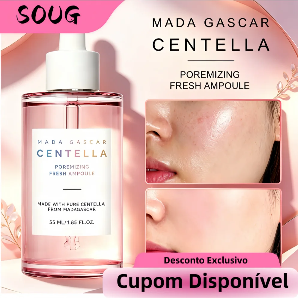 【Oferta Limitada】Madagascar Centella Asiatica Ampoule | 55ml | Soothing & Repairing Concentrate | For Sensitive & Irrit