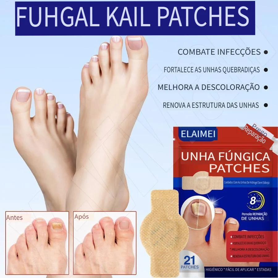 [Entrega 24 horas]​ Essência para Unhas dos Pés e Mãos​ - Combate Fungo de Unha, Reduz Espessura, Frete Grátis