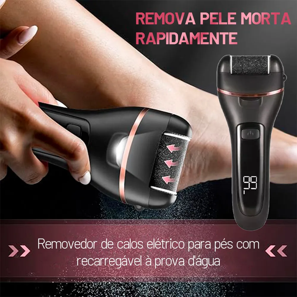 Kit Moedor De Pés Automático Recarregável Usb Lixa De Pé