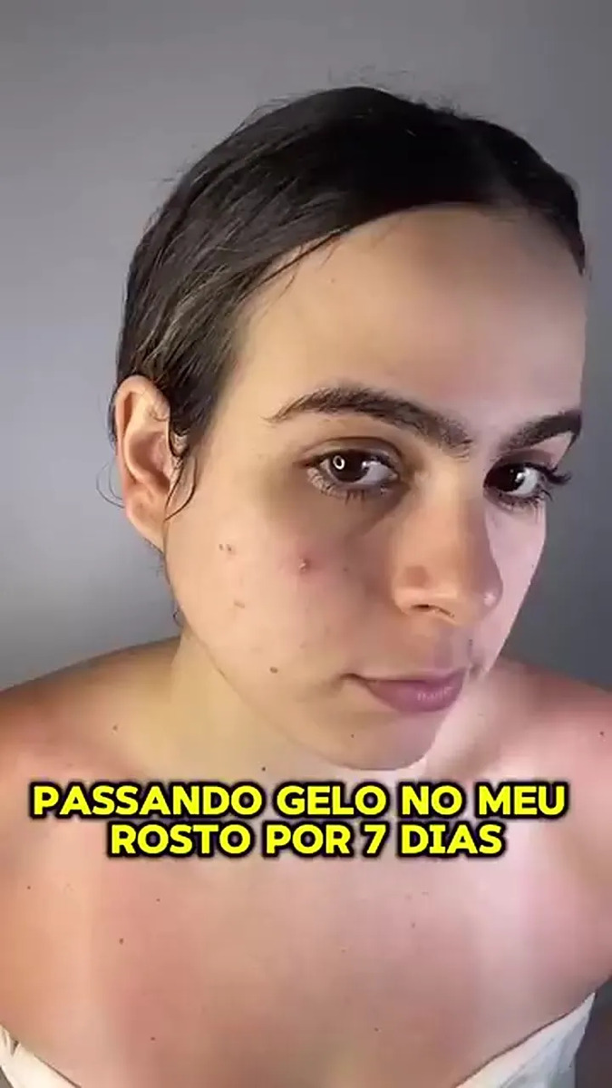 Rolo Facial De Gelo Silicone Copos De Massagem Cuida Pele Cor