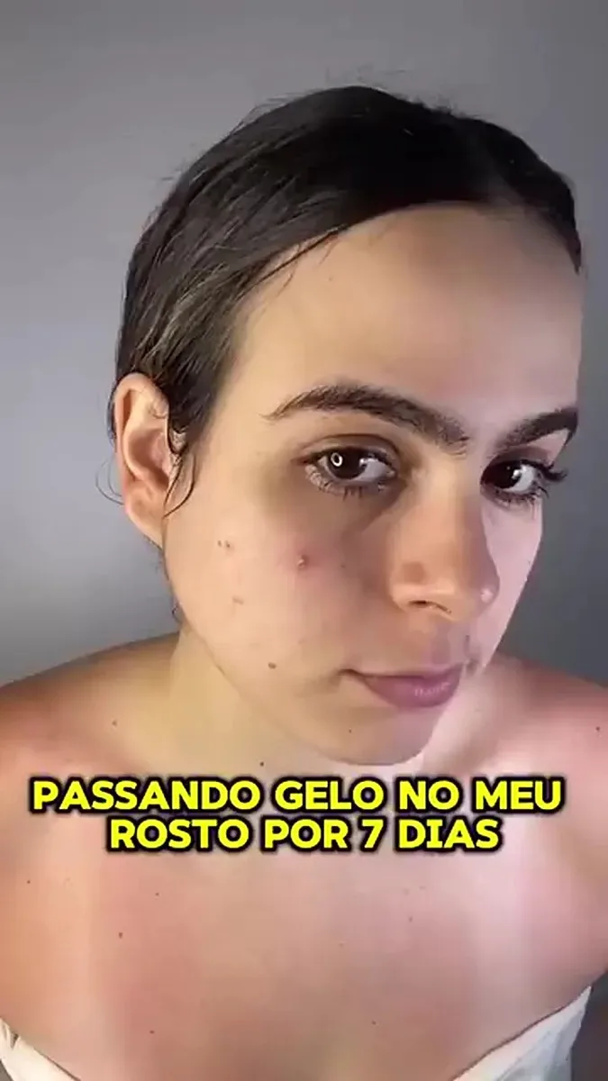 Rolo Facial De Gelo Silicone Copos De Massagem Cuida Pele Cor