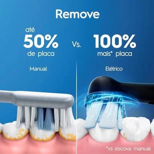 Escova de Dente Elétrica Oral-B Series iO2 para dentes 100% mais Limpos vs. uma Escova de Dente Manual Regular